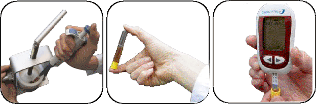 Medida de azúcar en patata con Glucolis